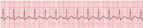 figure 37