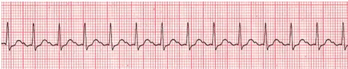 figure 37