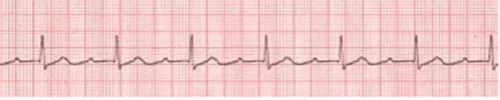 Figure 32