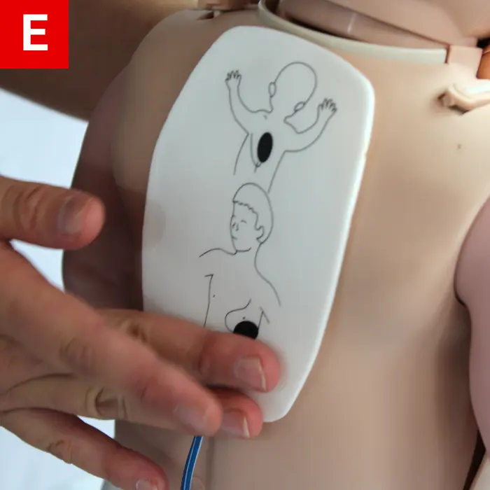 Ensure wires are attached to the AED box