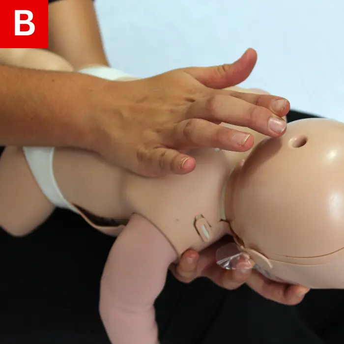 deliver five back blows between the infant’s shoulder blades