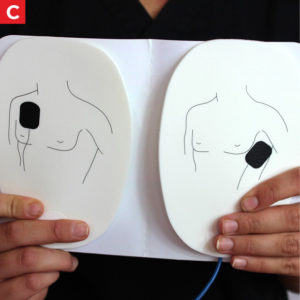 AED - Children C