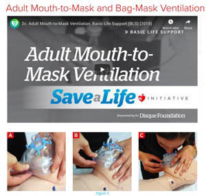 adult mouth to mask and bag ventilation