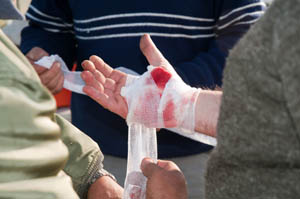 hand-wound-bandage-first-aid