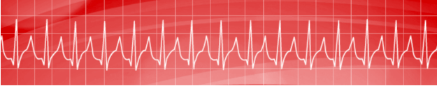 Accessory-Mediated Supraventricular Tachycardia