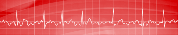 Atrial fibrillation