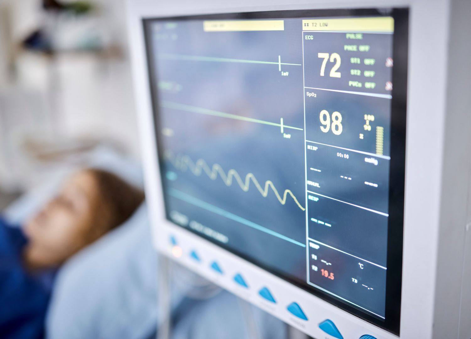 Close-up view of a hospital monitor displaying vital signs of a patient with potential hemodynamic instability.