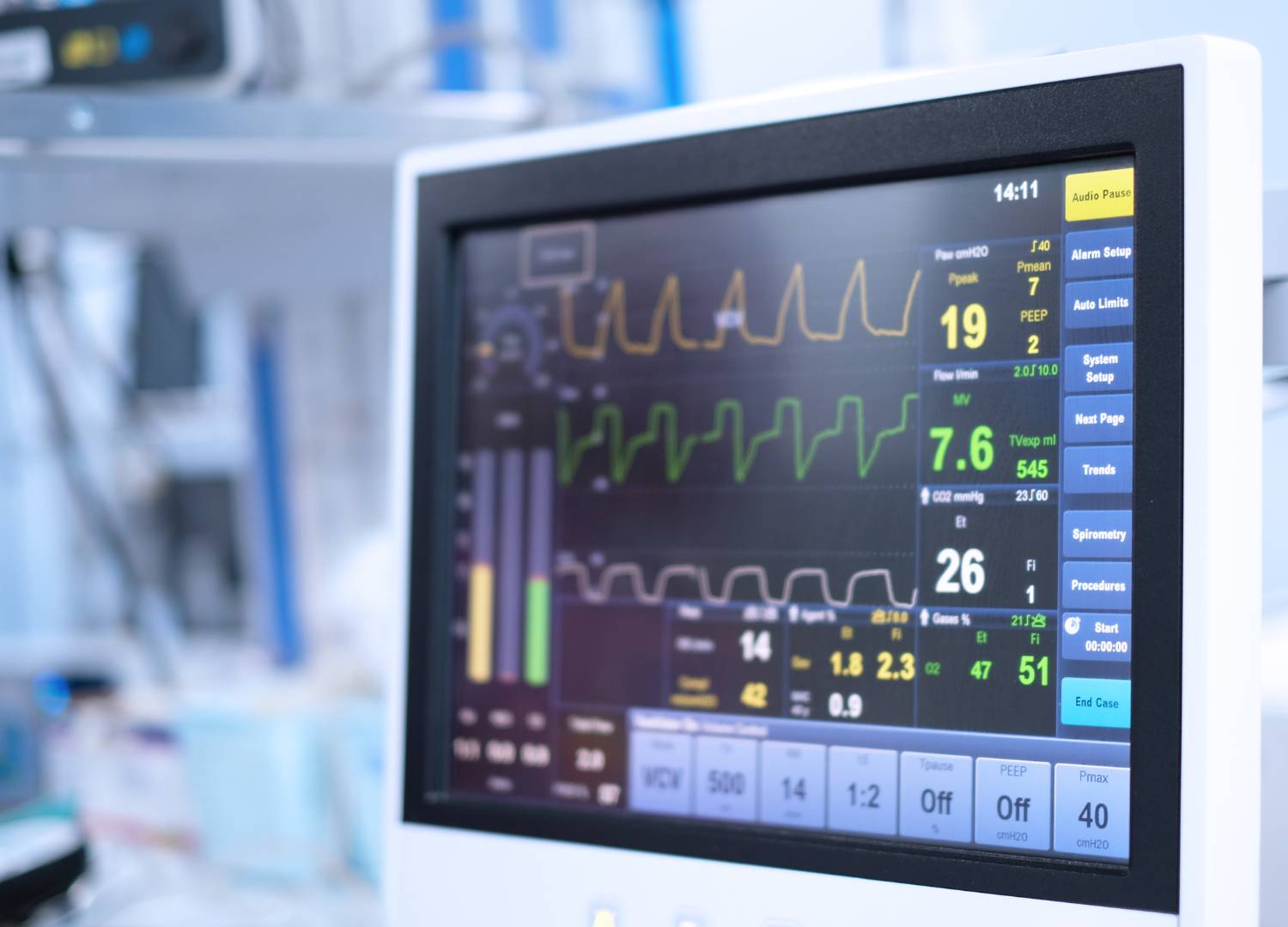 Heart monitor display showing vital signs.