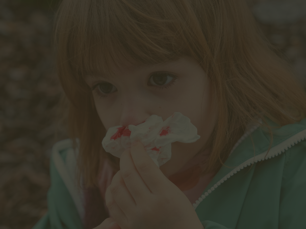 girl experiencing nosebleed